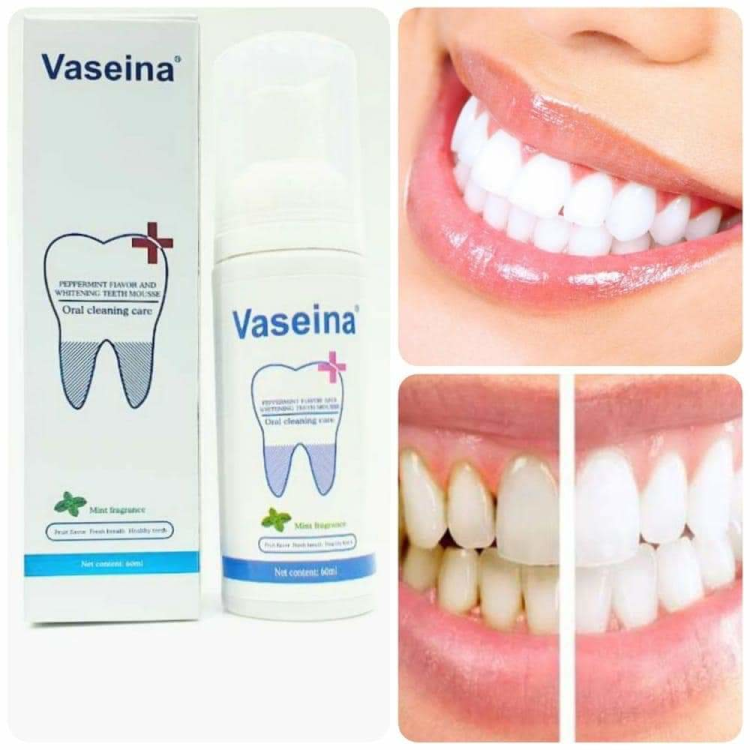 رغوة تبييض الأسنان