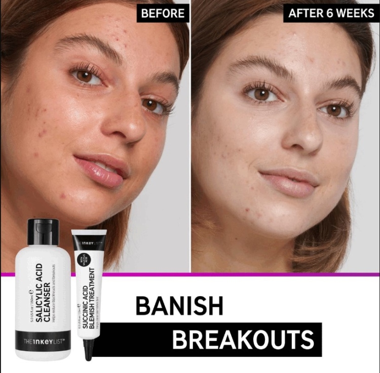 THE INKEY LIST, Back to Basics: Your Breakout Recipe