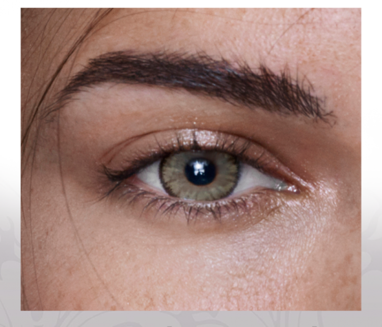 أنيستاتك ليما    ----       ANESTHETIC LIMA