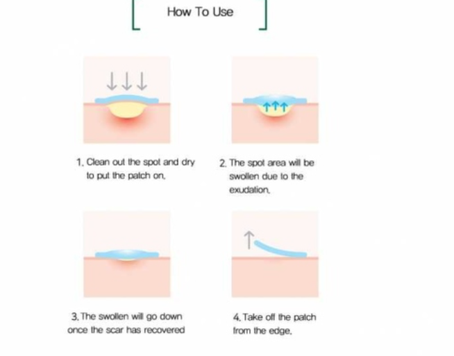 Some By Mi, 30 Days Miracle Clear Spot Patch