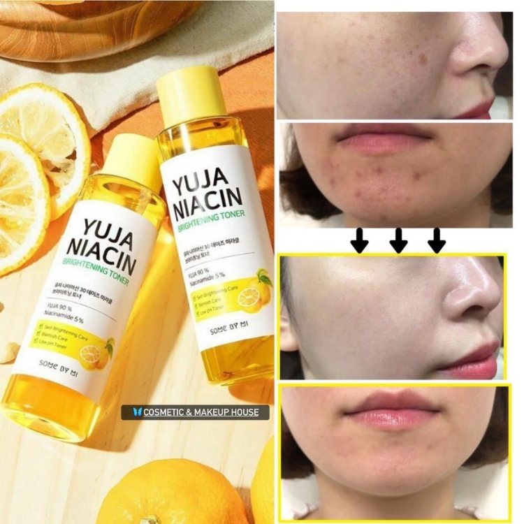SOME BY MI -YUJA NIACIN 30 DAYS MIRACLE BRIGHTENING TONER / 150ml