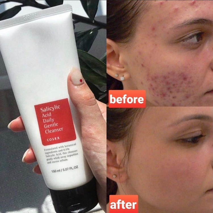 COSRX, Salicylic Acid Daily Gentle Cleanser